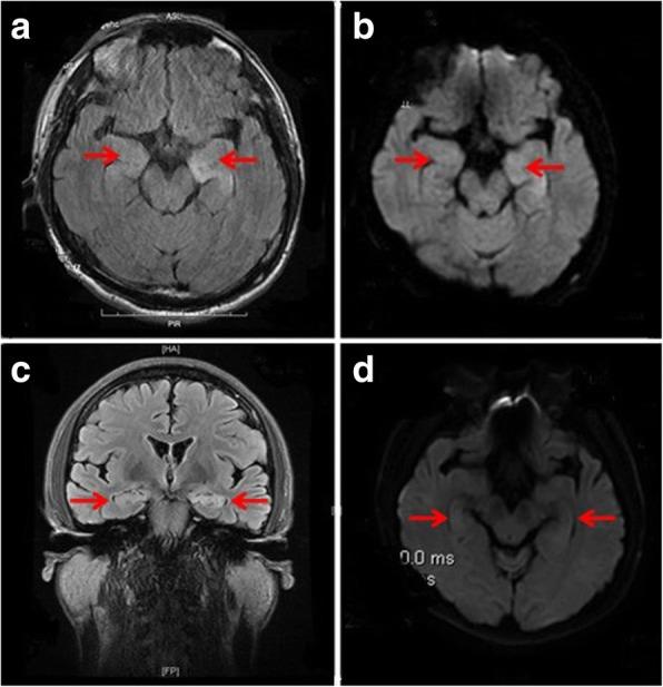 https://cdn.ncbi.nlm.nih.gov/pmc/blobs/20e0/6366039/1bc726983b04/12883_2019_1251_Fig1_HTML.jpg