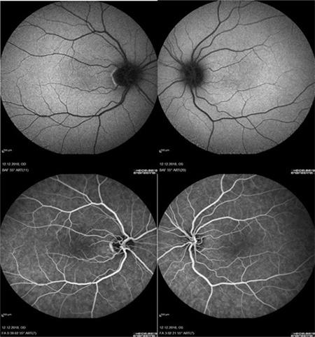 https://cdn.ncbi.nlm.nih.gov/pmc/blobs/20fa/7610051/a4b4b80f8faf/TJO-50-321-g2.jpg