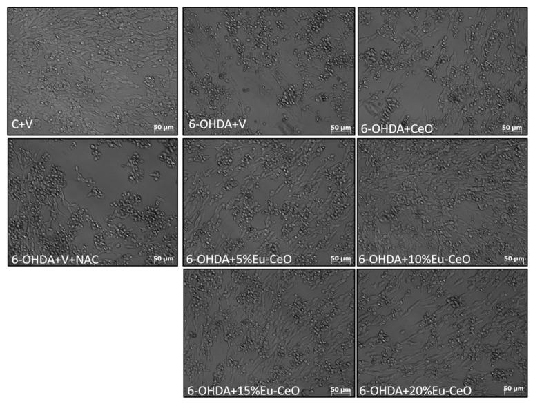 https://cdn.ncbi.nlm.nih.gov/pmc/blobs/2109/10931453/331ec0e72abb/ijms-25-02501-g008.jpg