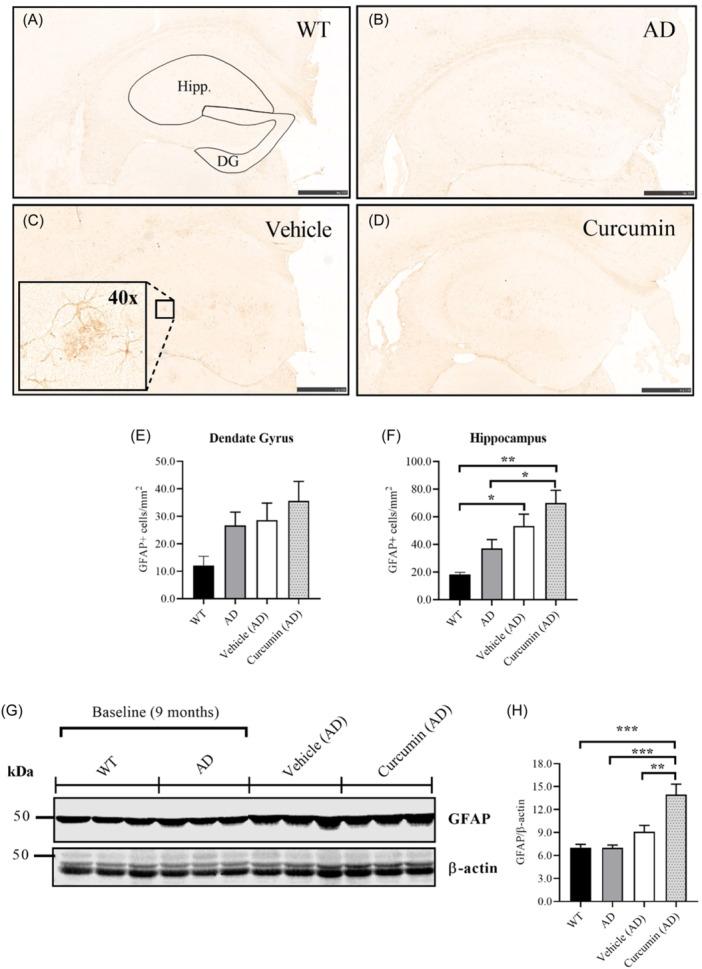 https://cdn.ncbi.nlm.nih.gov/pmc/blobs/2110/11649387/10490603518c/IBRA-10-500-g004.jpg