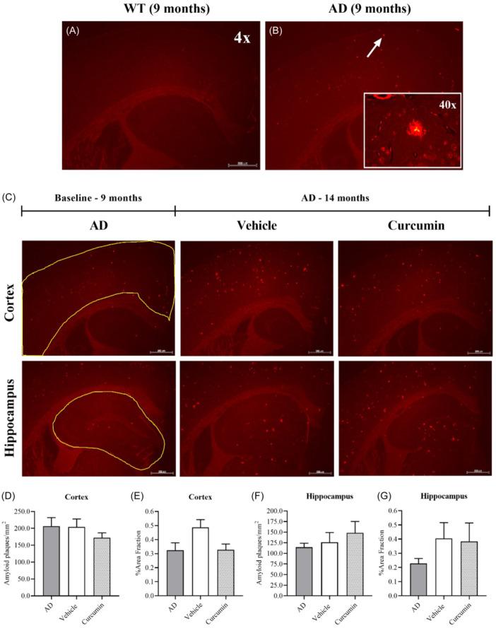 https://cdn.ncbi.nlm.nih.gov/pmc/blobs/2110/11649387/317b8013ed96/IBRA-10-500-g002.jpg