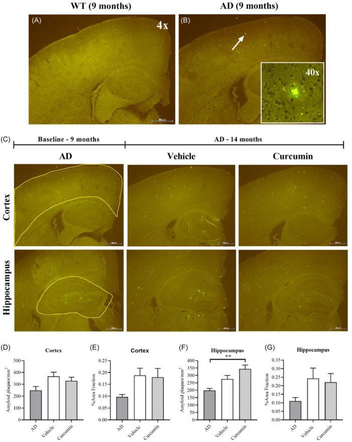https://cdn.ncbi.nlm.nih.gov/pmc/blobs/2110/11649387/c3163223d165/IBRA-10-500-g001.jpg