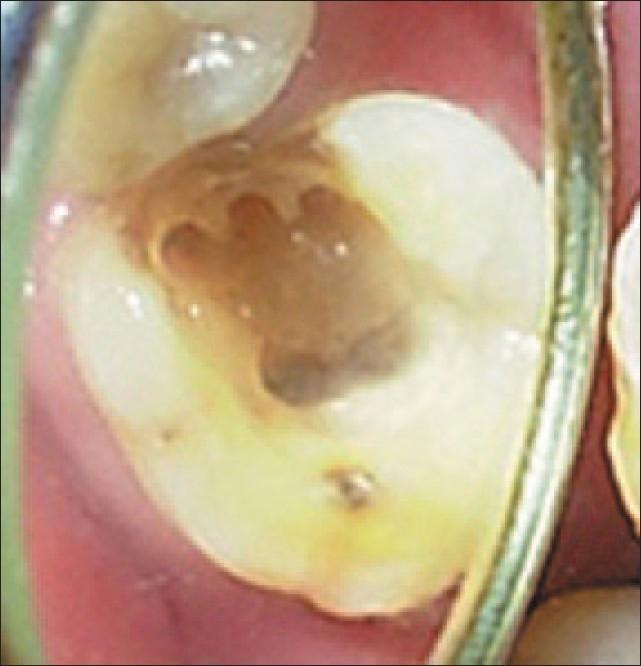 https://cdn.ncbi.nlm.nih.gov/pmc/blobs/2114/2848812/a83777082783/JCD-12-37-g002.jpg