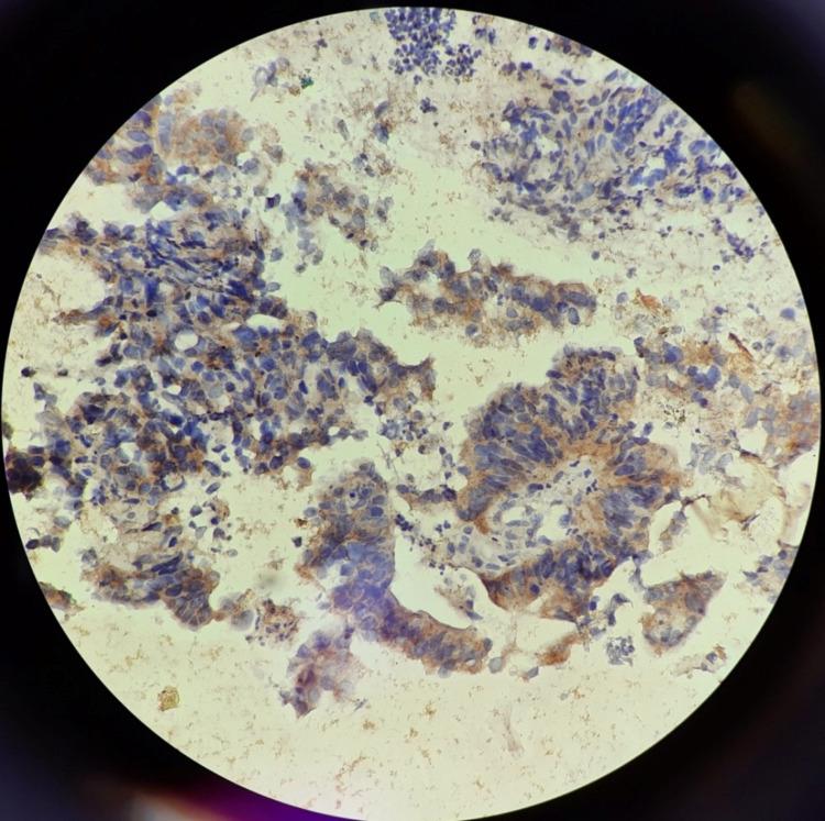 https://cdn.ncbi.nlm.nih.gov/pmc/blobs/211a/8976506/7da2e073df34/cureus-0014-00000022811-i02.jpg