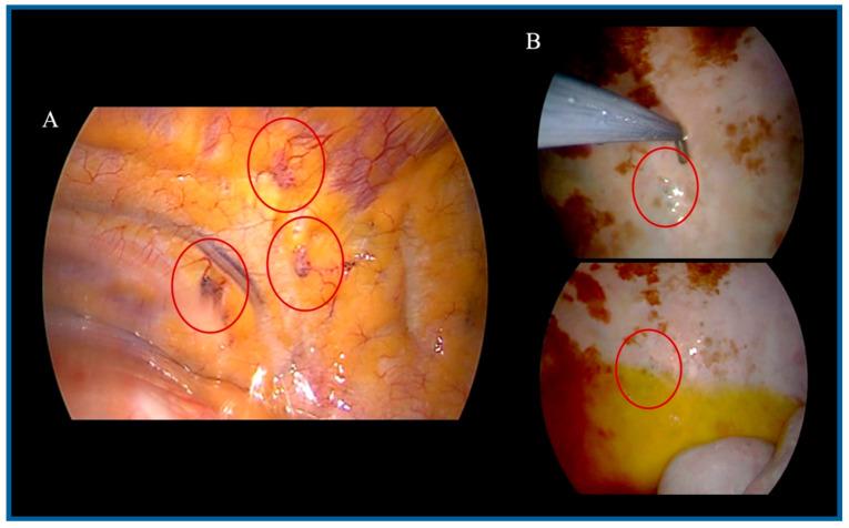 https://cdn.ncbi.nlm.nih.gov/pmc/blobs/211d/12195480/4fb17b437285/medsci-13-00072-g003.jpg