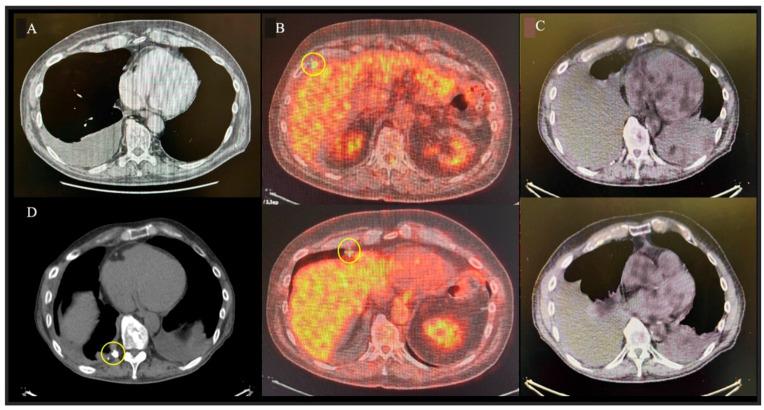 https://cdn.ncbi.nlm.nih.gov/pmc/blobs/211d/12195480/9dfb1dae0cf4/medsci-13-00072-g002.jpg