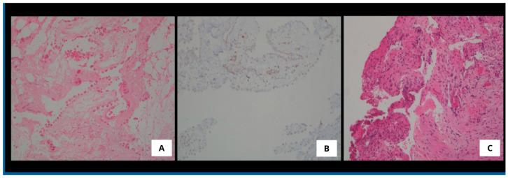 https://cdn.ncbi.nlm.nih.gov/pmc/blobs/211d/12195480/b385032f01aa/medsci-13-00072-g004.jpg