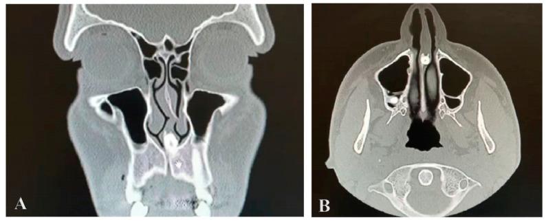 https://cdn.ncbi.nlm.nih.gov/pmc/blobs/2124/12225496/8ff4dad284e4/reports-07-00046-g001.jpg