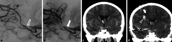 https://cdn.ncbi.nlm.nih.gov/pmc/blobs/2126/12174253/ef42ba4685aa/62_2024_1480_Fig2_HTML.jpg