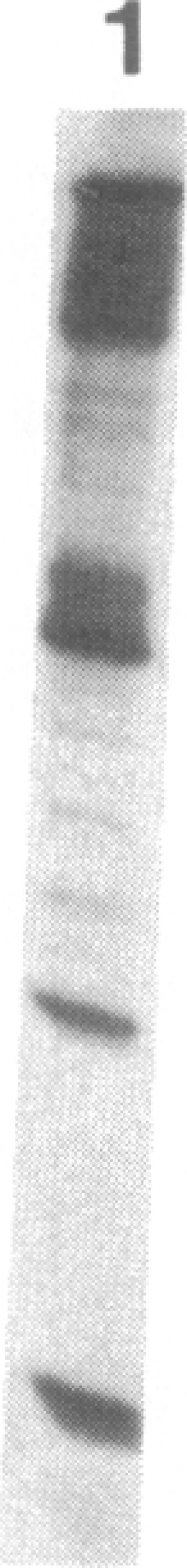 https://cdn.ncbi.nlm.nih.gov/pmc/blobs/2128/391385/4c17e55b1870/pnas00362-0158-b.jpg