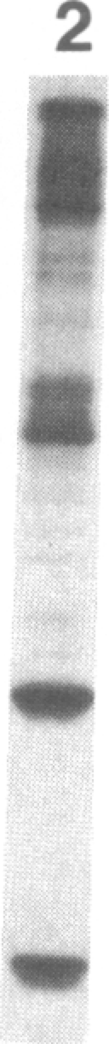 https://cdn.ncbi.nlm.nih.gov/pmc/blobs/2128/391385/f6c0a5f14b9c/pnas00362-0158-a.jpg