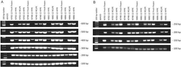 https://cdn.ncbi.nlm.nih.gov/pmc/blobs/2133/4766796/cff213b1ada7/clinneuropathol-35-003-02.jpg