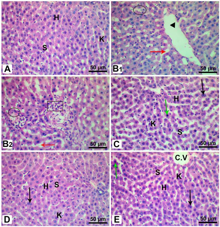 https://cdn.ncbi.nlm.nih.gov/pmc/blobs/2134/10535482/bcdf34e66698/pharmaceutics-15-02306-g015.jpg