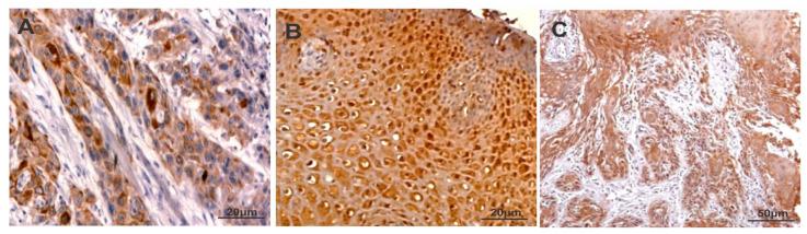 https://cdn.ncbi.nlm.nih.gov/pmc/blobs/2137/8656999/ce8bb18e390d/cancers-13-05895-g001.jpg