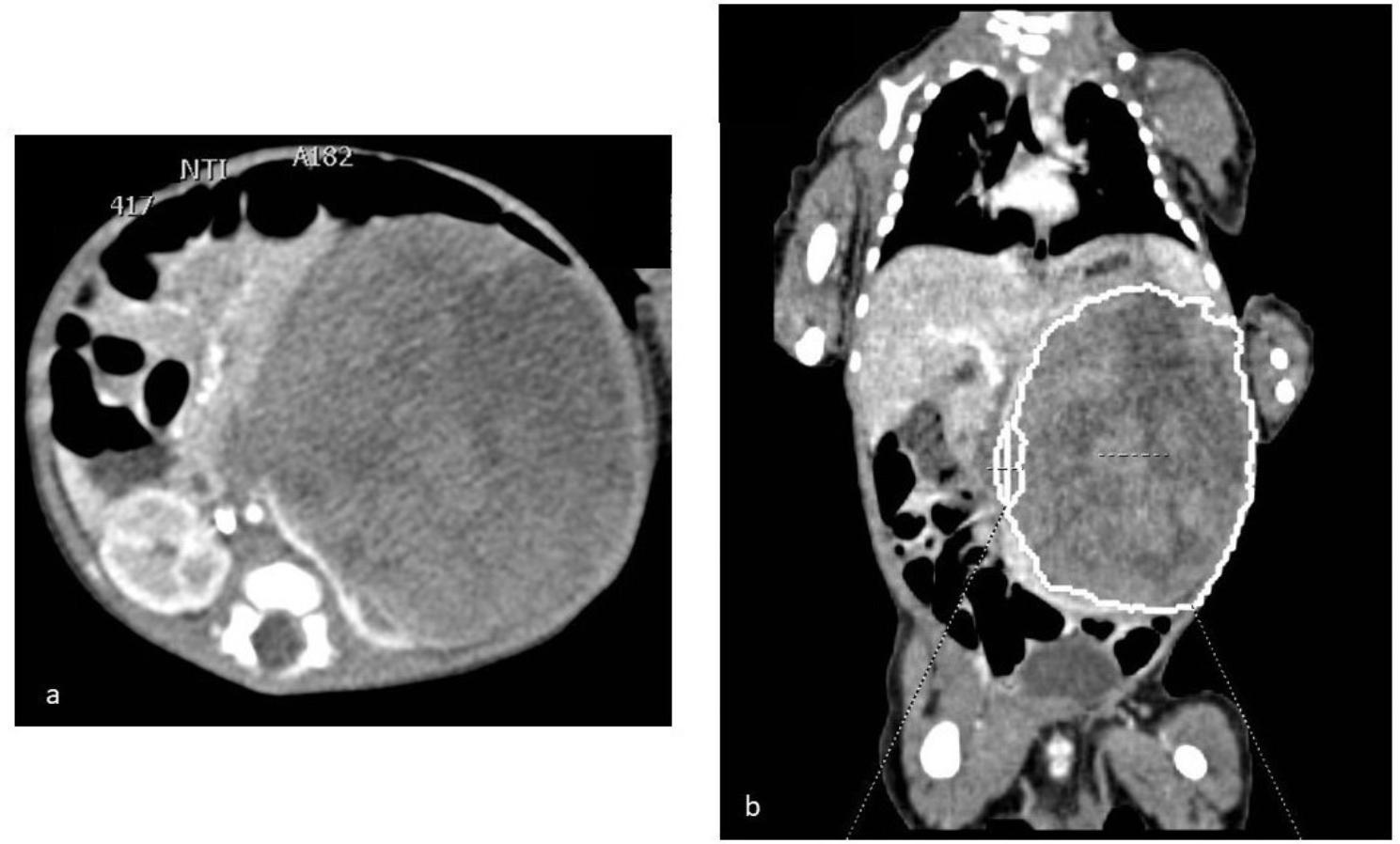 https://cdn.ncbi.nlm.nih.gov/pmc/blobs/2143/10510132/25955475829e/13052_2023_1523_Fig3_HTML.jpg