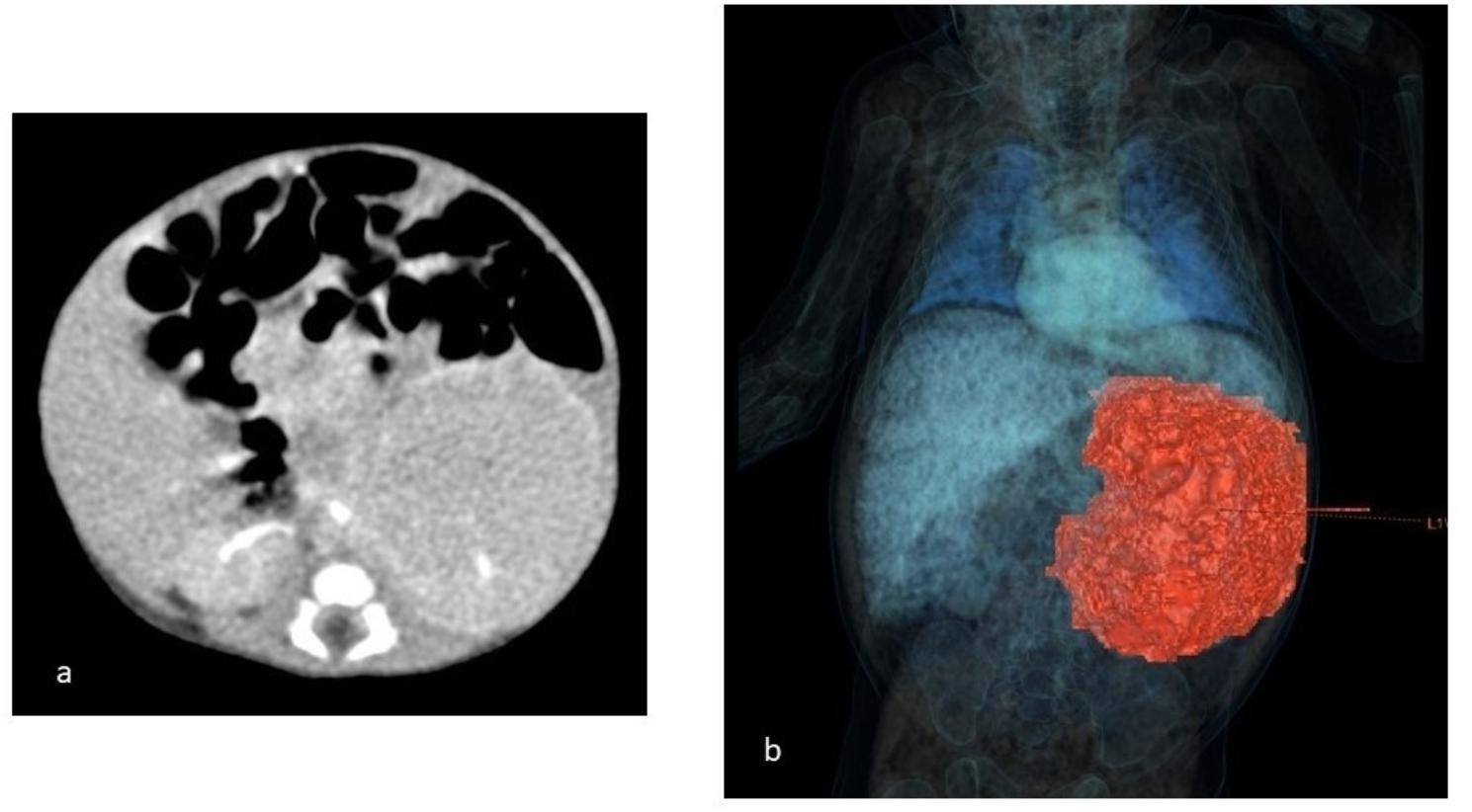 https://cdn.ncbi.nlm.nih.gov/pmc/blobs/2143/10510132/d99be139b5b8/13052_2023_1523_Fig1_HTML.jpg