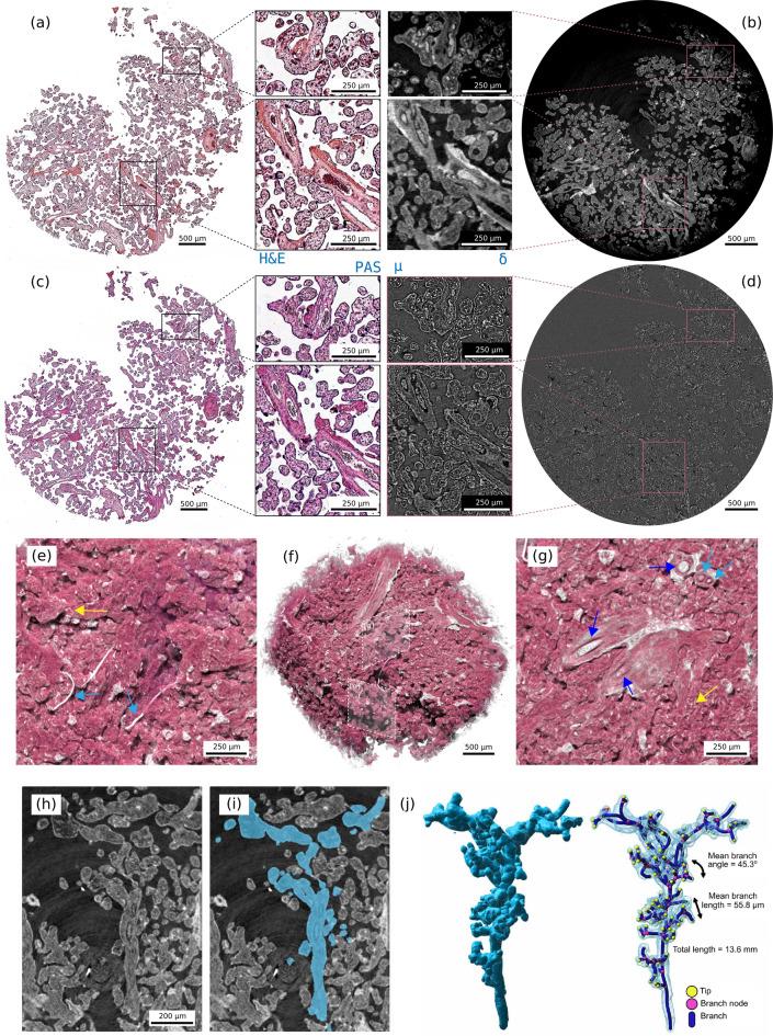 https://cdn.ncbi.nlm.nih.gov/pmc/blobs/214a/11739398/5243123d3c8a/41598_2025_85105_Fig4_HTML.jpg