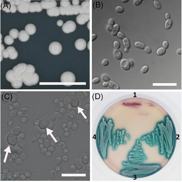 https://cdn.ncbi.nlm.nih.gov/pmc/blobs/214a/9936790/e7304220e62e/myad009fig3.jpg