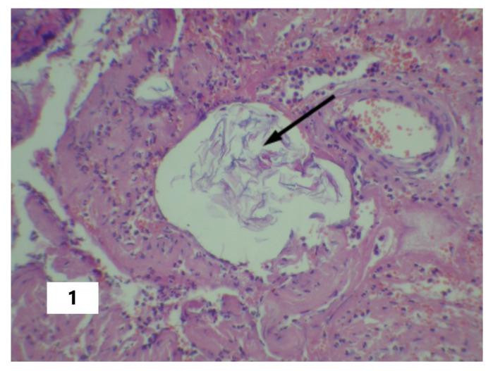 https://cdn.ncbi.nlm.nih.gov/pmc/blobs/214b/10058189/9790ce4458cd/pathophysiology-30-00006-g001.jpg