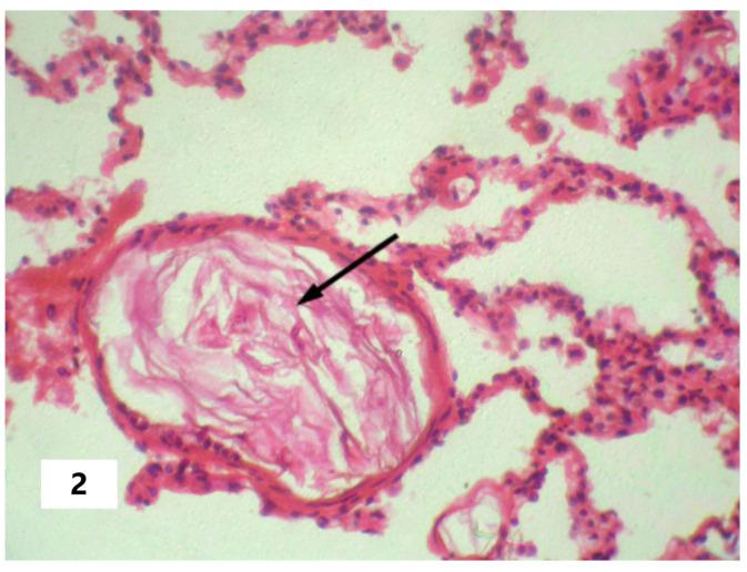 https://cdn.ncbi.nlm.nih.gov/pmc/blobs/214b/10058189/bad4fb7abc89/pathophysiology-30-00006-g002.jpg