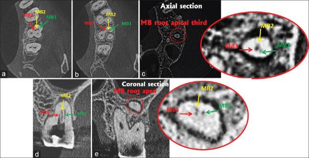 https://cdn.ncbi.nlm.nih.gov/pmc/blobs/214d/8896129/d8aad63f31aa/JCD-24-404-g002.jpg