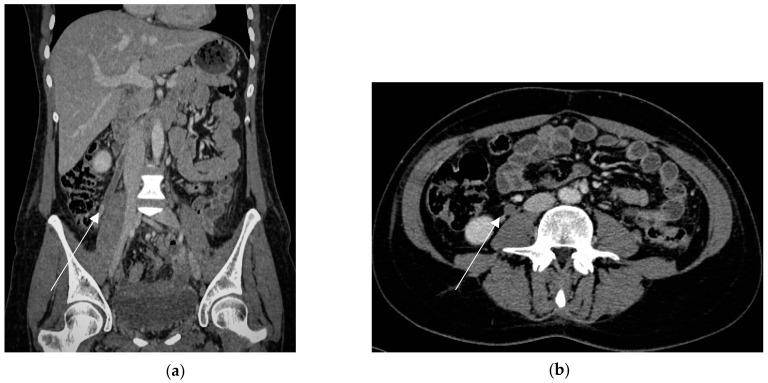 https://cdn.ncbi.nlm.nih.gov/pmc/blobs/2153/10528125/0658b2869f29/diagnostics-13-02909-g011.jpg