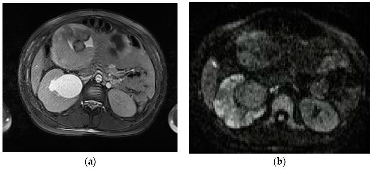 https://cdn.ncbi.nlm.nih.gov/pmc/blobs/2153/10528125/189fbf33fa32/diagnostics-13-02909-g007.jpg