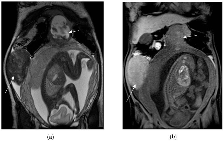 https://cdn.ncbi.nlm.nih.gov/pmc/blobs/2153/10528125/31a4f1f75070/diagnostics-13-02909-g010.jpg