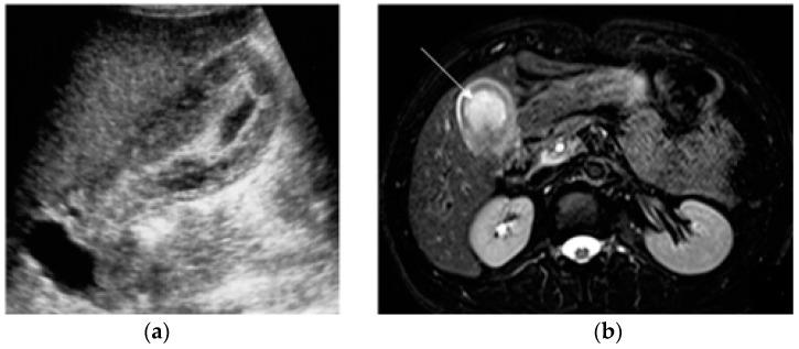 https://cdn.ncbi.nlm.nih.gov/pmc/blobs/2153/10528125/3d21f9e4384d/diagnostics-13-02909-g005.jpg
