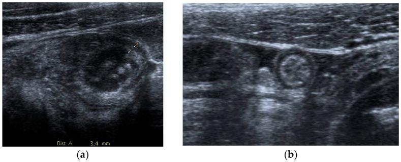 https://cdn.ncbi.nlm.nih.gov/pmc/blobs/2153/10528125/8601d68ec81d/diagnostics-13-02909-g001.jpg
