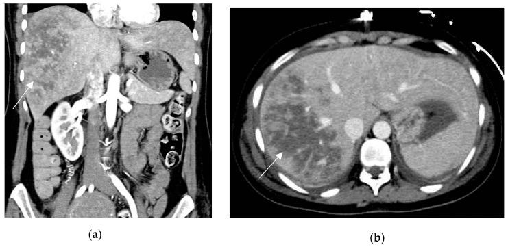 https://cdn.ncbi.nlm.nih.gov/pmc/blobs/2153/10528125/860ce650ae47/diagnostics-13-02909-g004.jpg