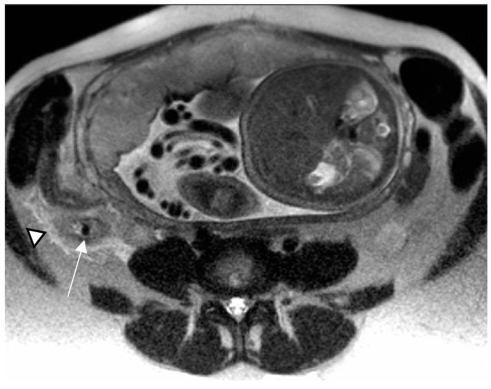 https://cdn.ncbi.nlm.nih.gov/pmc/blobs/2153/10528125/8fa0c5e83d10/diagnostics-13-02909-g002.jpg