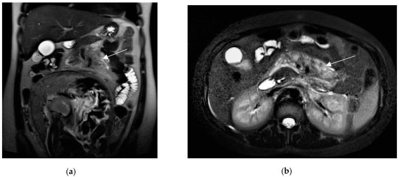 https://cdn.ncbi.nlm.nih.gov/pmc/blobs/2153/10528125/ac2709bccde3/diagnostics-13-02909-g006.jpg