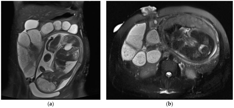 https://cdn.ncbi.nlm.nih.gov/pmc/blobs/2153/10528125/ebb0248a3def/diagnostics-13-02909-g003.jpg