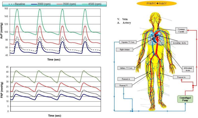 https://cdn.ncbi.nlm.nih.gov/pmc/blobs/2154/9854437/7b4cb6db797e/bioengineering-10-00060-g005.jpg