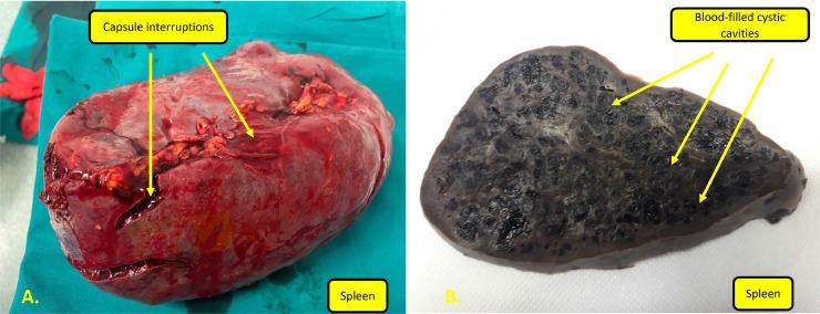 https://cdn.ncbi.nlm.nih.gov/pmc/blobs/215b/8416965/49f076c92d93/gr2.jpg