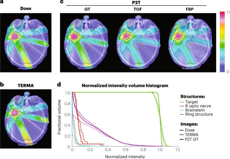 https://cdn.ncbi.nlm.nih.gov/pmc/blobs/215c/10038801/b877e4b8e772/41551_2022_953_Fig5_HTML.jpg