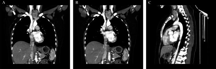 https://cdn.ncbi.nlm.nih.gov/pmc/blobs/215c/12284678/bf31c0fe7b5d/gr1.jpg