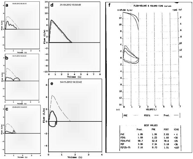 https://cdn.ncbi.nlm.nih.gov/pmc/blobs/215f/10233185/4077256a239e/12098_2023_4588_Fig1_HTML.jpg