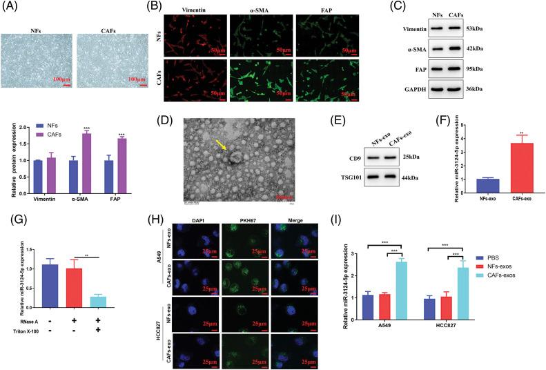 https://cdn.ncbi.nlm.nih.gov/pmc/blobs/2160/11671617/52abdb95471f/OncolRes-33-54141-f002.jpg