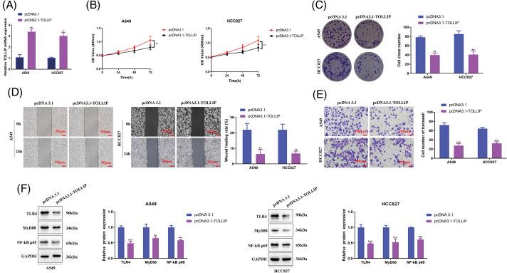 https://cdn.ncbi.nlm.nih.gov/pmc/blobs/2160/11671617/742dd1466043/OncolRes-33-54141-f005.jpg