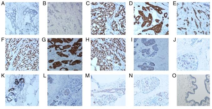 https://cdn.ncbi.nlm.nih.gov/pmc/blobs/2164/6403512/8c1eb6bd39ba/ol-17-04-3687-g00.jpg