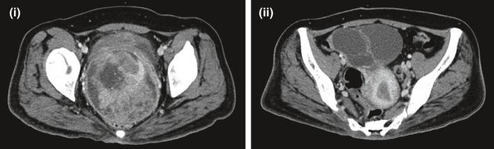 https://cdn.ncbi.nlm.nih.gov/pmc/blobs/2168/7869391/84272359cc66/CCR3-9-995-g001.jpg
