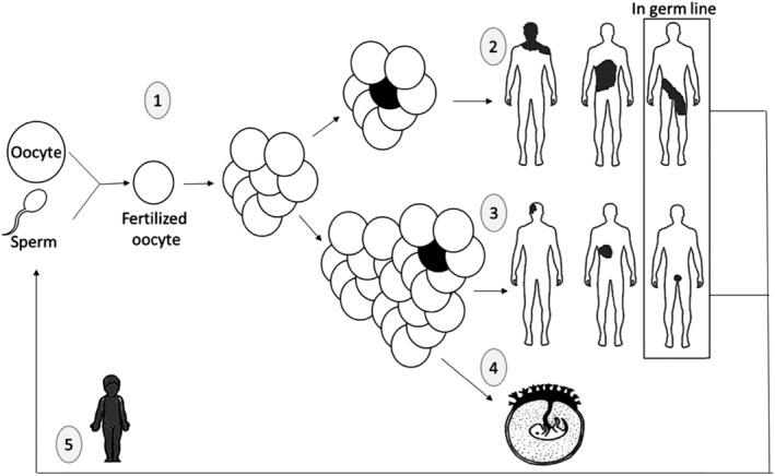 https://cdn.ncbi.nlm.nih.gov/pmc/blobs/216b/6973016/817284ed3856/EM-61-55-g001.jpg