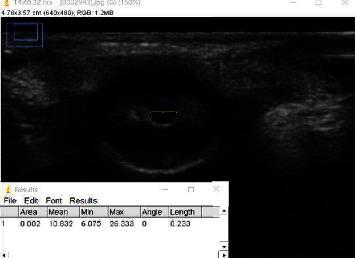 https://cdn.ncbi.nlm.nih.gov/pmc/blobs/216c/9303082/6022a2a6aa61/IJCLP2022-6320973.002.jpg