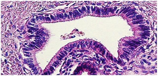 https://cdn.ncbi.nlm.nih.gov/pmc/blobs/2171/6749781/531c53a3713f/10.1177_2632010X19876934-fig2.jpg