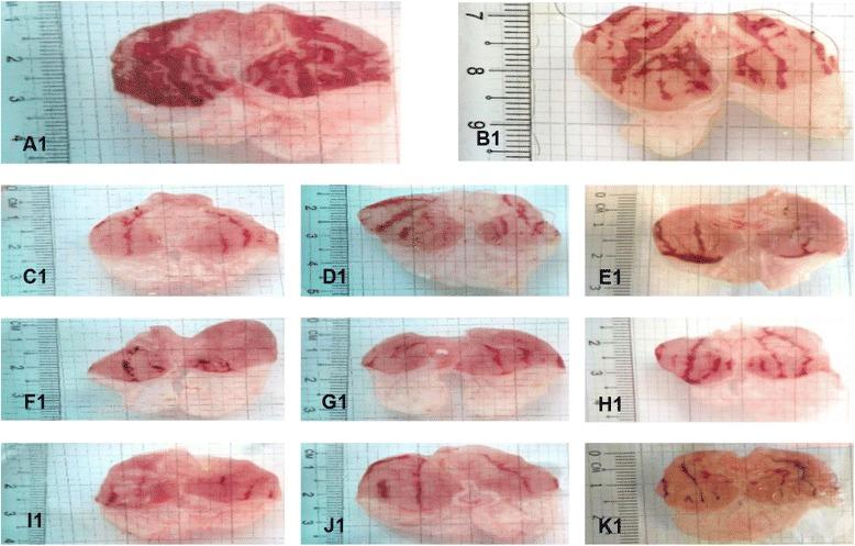 https://cdn.ncbi.nlm.nih.gov/pmc/blobs/2178/5679158/ad2ae8e3f092/12906_2017_1992_Fig2_HTML.jpg