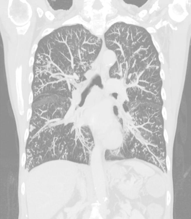https://cdn.ncbi.nlm.nih.gov/pmc/blobs/217b/5061073/9f0866c01c56/gr1.jpg