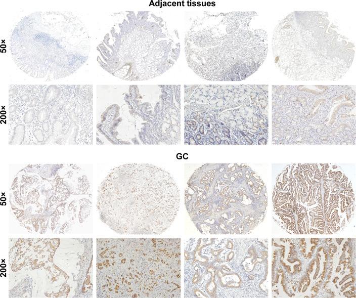 https://cdn.ncbi.nlm.nih.gov/pmc/blobs/2189/5511018/4d24398a9a83/ott-10-3337Fig2.jpg