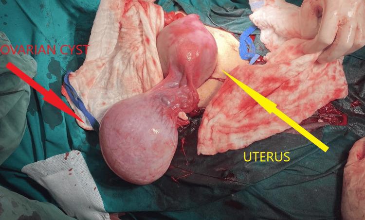 https://cdn.ncbi.nlm.nih.gov/pmc/blobs/2191/12003962/3f7c8e9776b9/cureus-0017-00000080744-i02.jpg